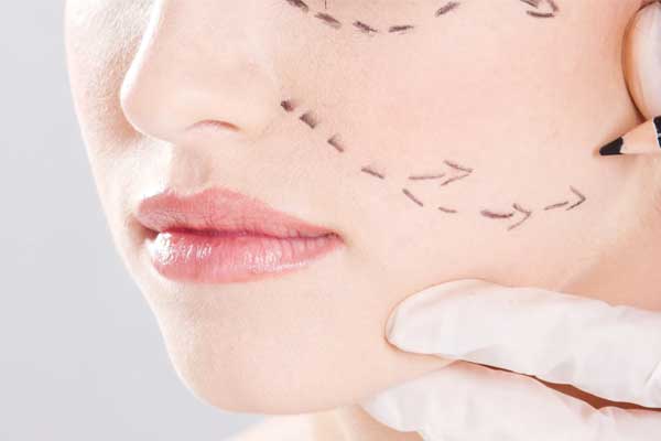 Facelift surgery in Iran