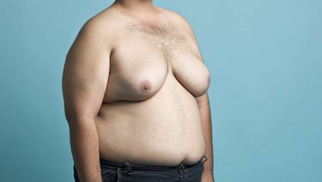 Gynecomastia risks and side effects