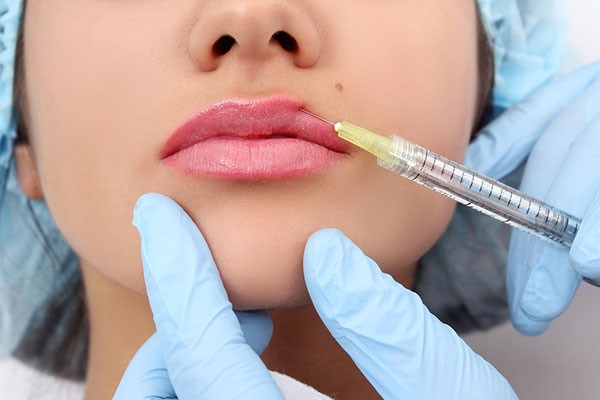 Risks or Benefits of lip fillers